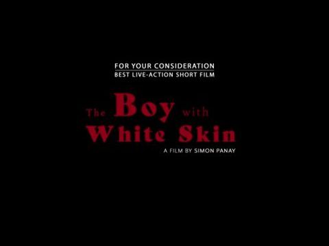 The Boy With White Skin