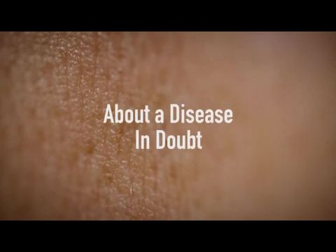 Skin Deep: The Battle Over Morgellons