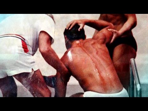 Greg Louganis - Megugrani a lehetetlent