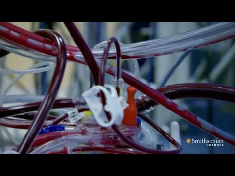 How to Build a Bionic Man