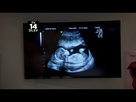 Kegyetlen csillogás